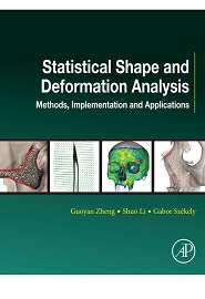 Statistical Shape and Deformation Analysis: Methods, Implementation and Applications